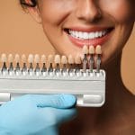 لمینت دندان چیست؟ انواع، مراحل، هزینه و نکات مراقبتی