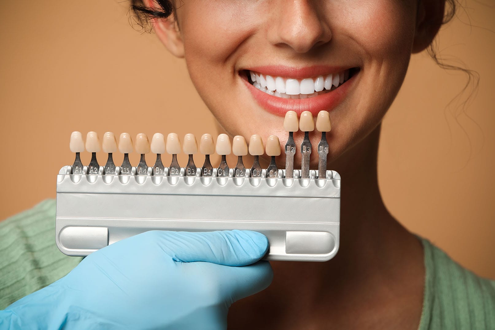 لمینت دندان چیست؟ انواع، مراحل، هزینه و نکات مراقبتی