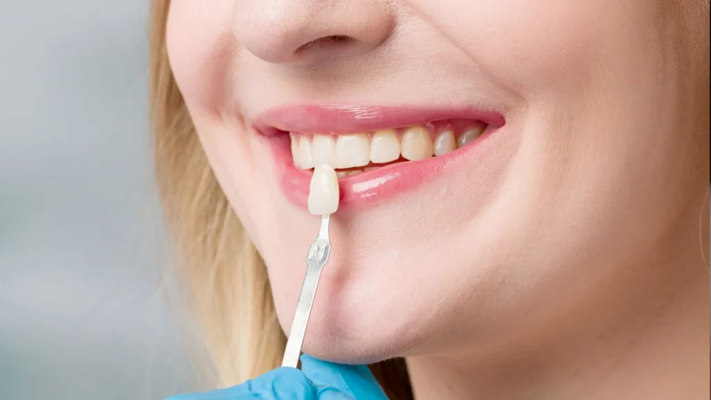 چرا لمینت به دندان آسیب نمی‌زند؟