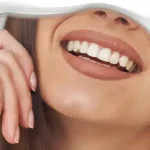 تکنیک لیرینگ کامپوزیت